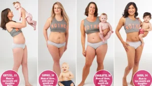 Read more about the article Can You Get Stretch Marks From Losing Weight for 2026